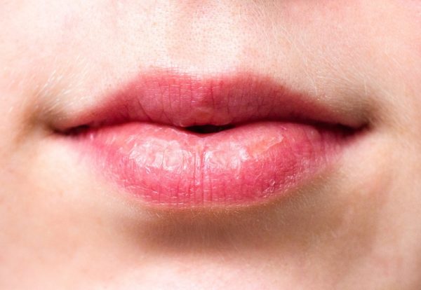 labios oscuros